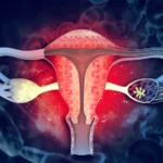 Journal of Gynaecology & Obstetrics